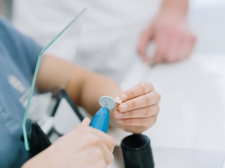 Zahn wird im Dentallabor geschliffen