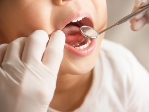 Zähne eines Kindes werden mit Instrumenten behandelt